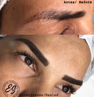 TATTO COVERAGE/CUBRIMIENTO DE TATUAJE