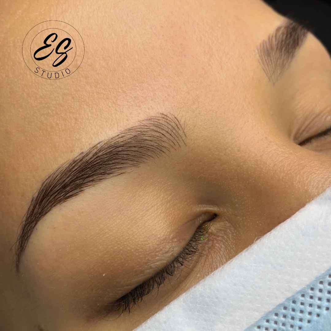 ULTRAREALISMO BY SURI