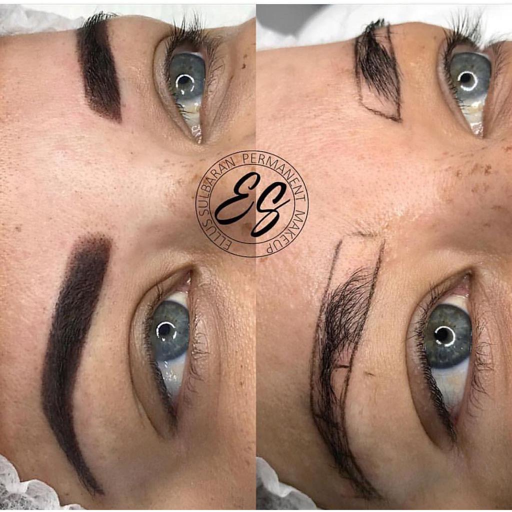 Reconstruccion de cejas