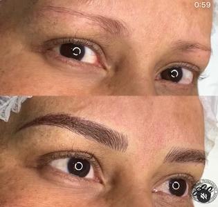 RECONSTRUCCION MIXTA