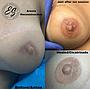 RECONSTRUCCION AREOLAR/ AREOLA TATTO